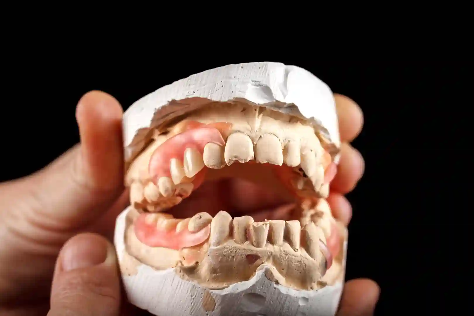 Partial dentures 