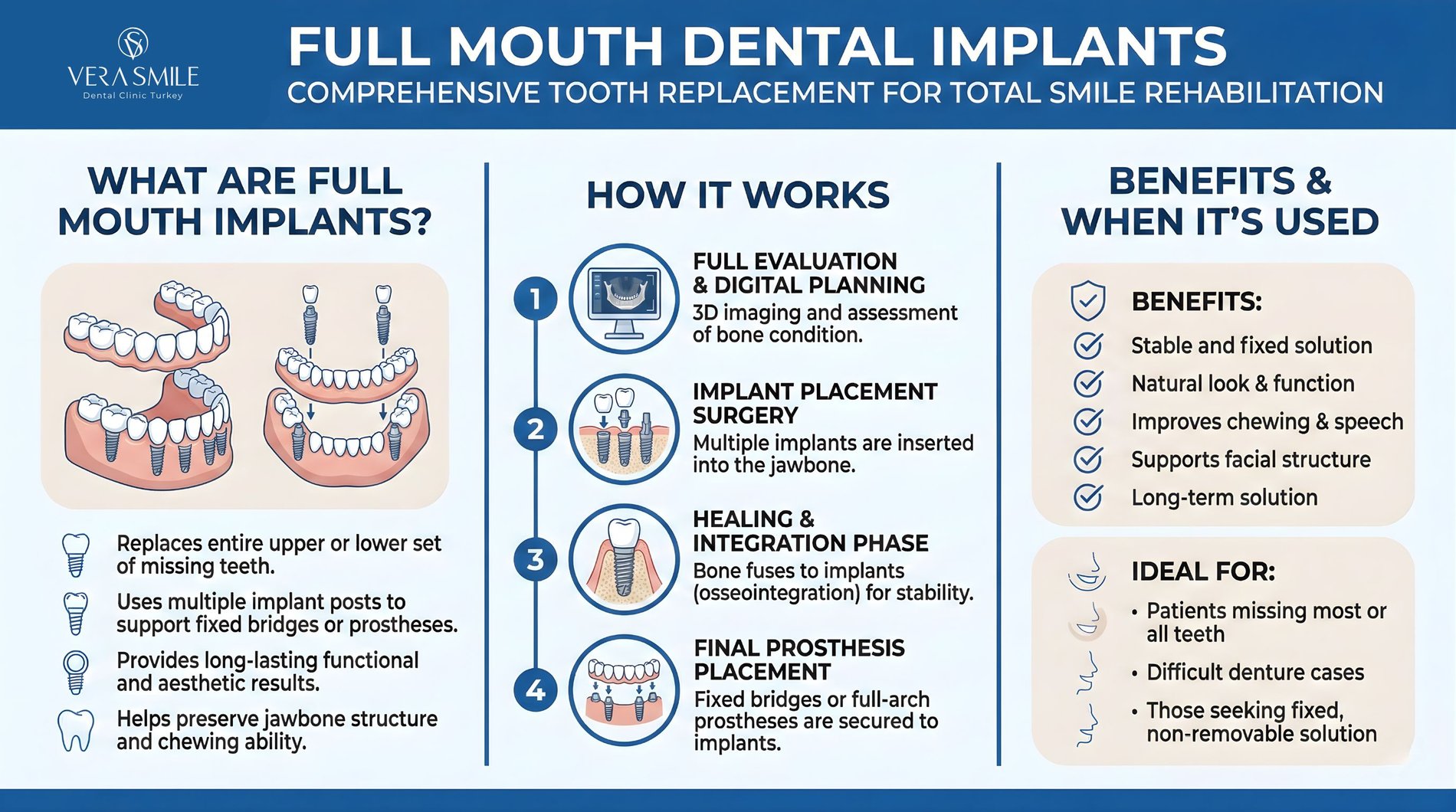 https___www.verasmile.com_dental-implants_full-mouth