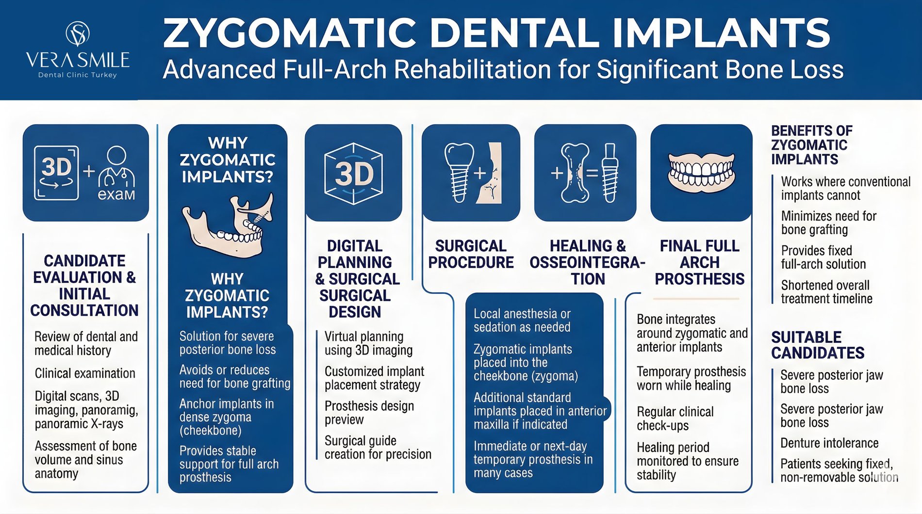 https___www.verasmile.com_dental-implants_zygomatic