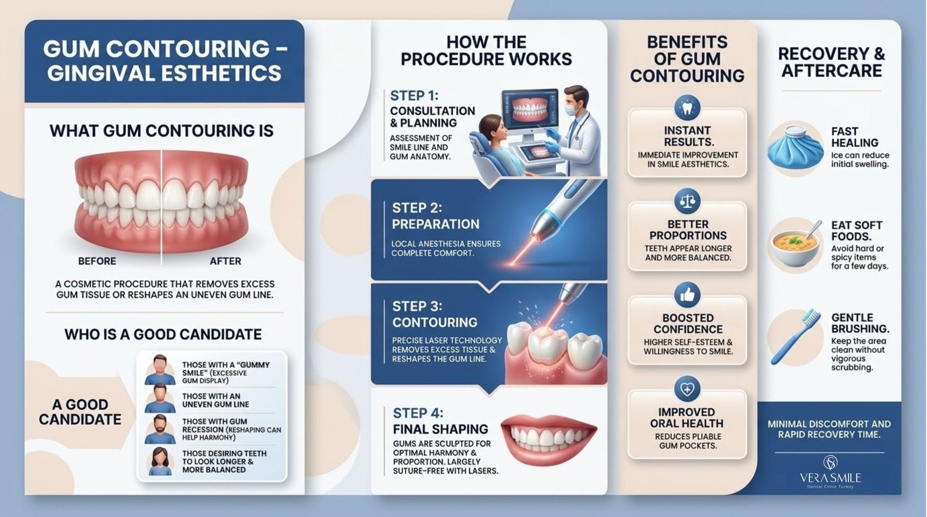 https___www.verasmile.com_gingival-esthetics_gum-contouring
