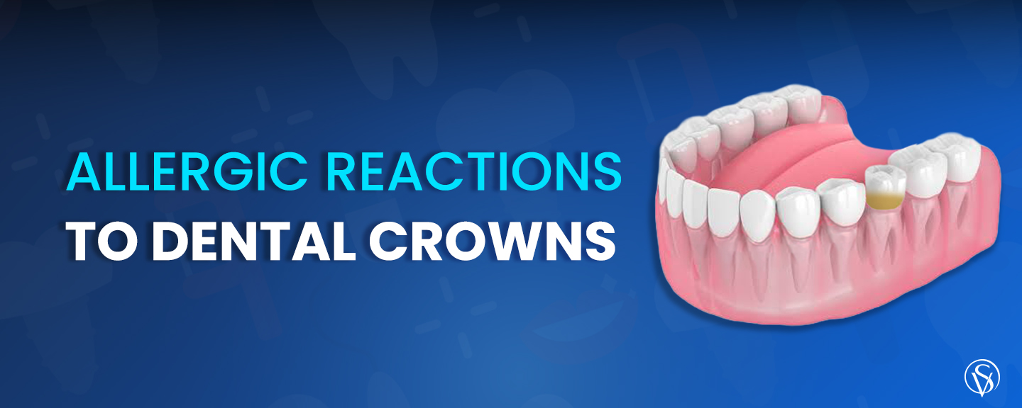 Allergic reactions to dental crowns most often involve nickel and base metals. See symptoms, patch testing and metal-free crown options like zirconia.