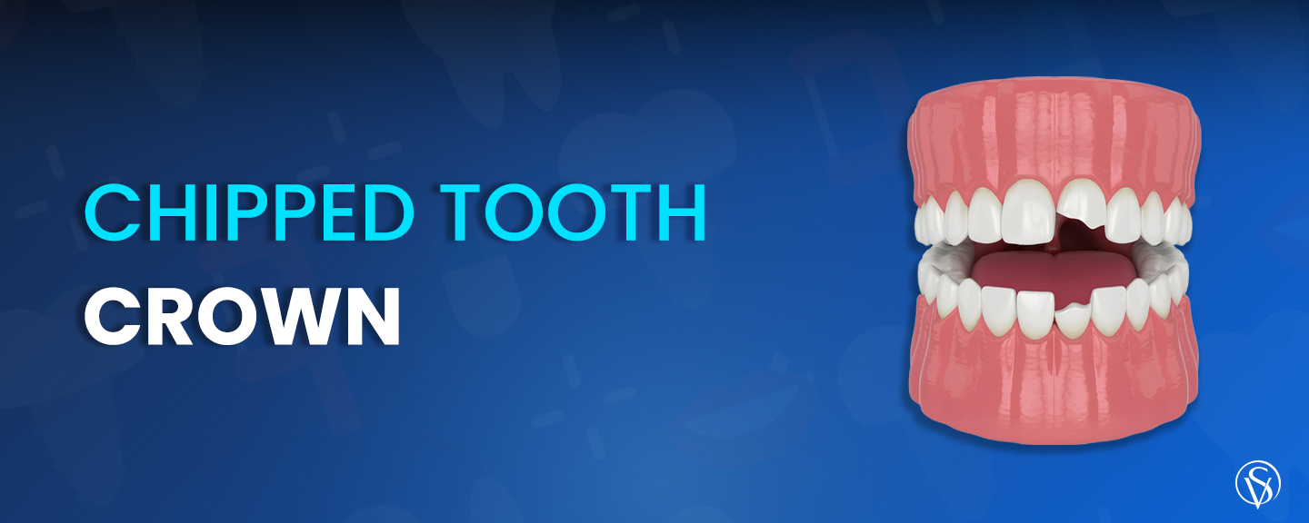 chipped teeth dental crown