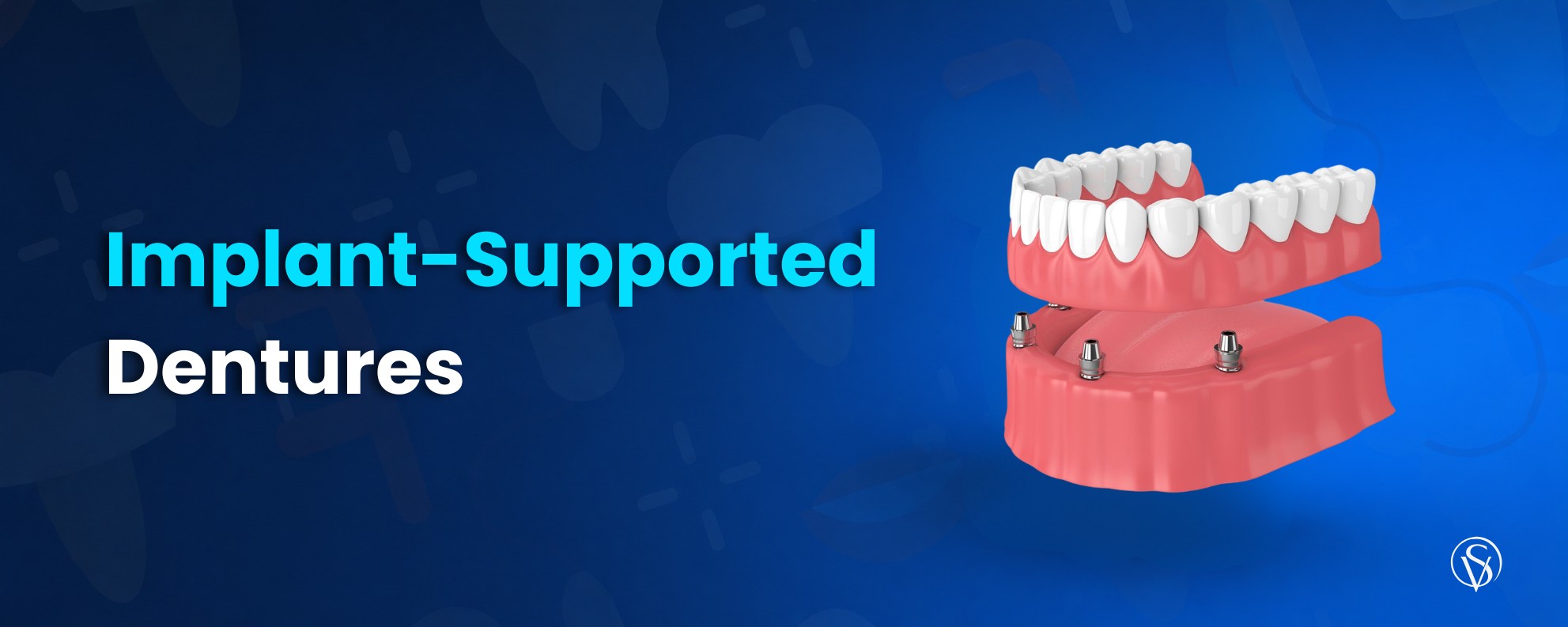 Implant-Supported Dentures. types of Implant-Supported dentures. cost of Implant-Supported dentures. all we should know about Implant-Supported dentures