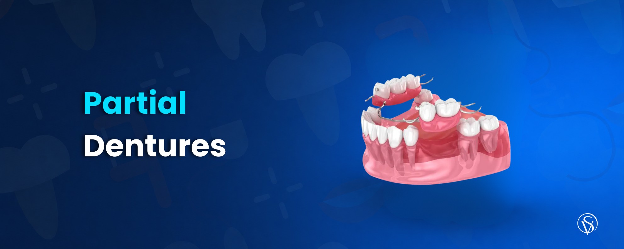 types of Partial Dentures