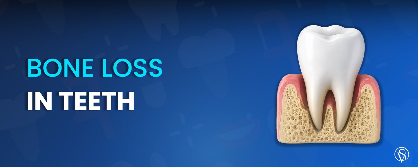 bone loss in teeth