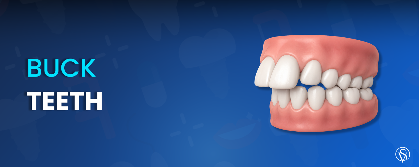 Buck Teeth