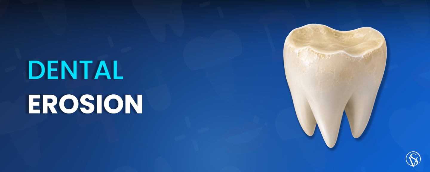 Dental Erosion