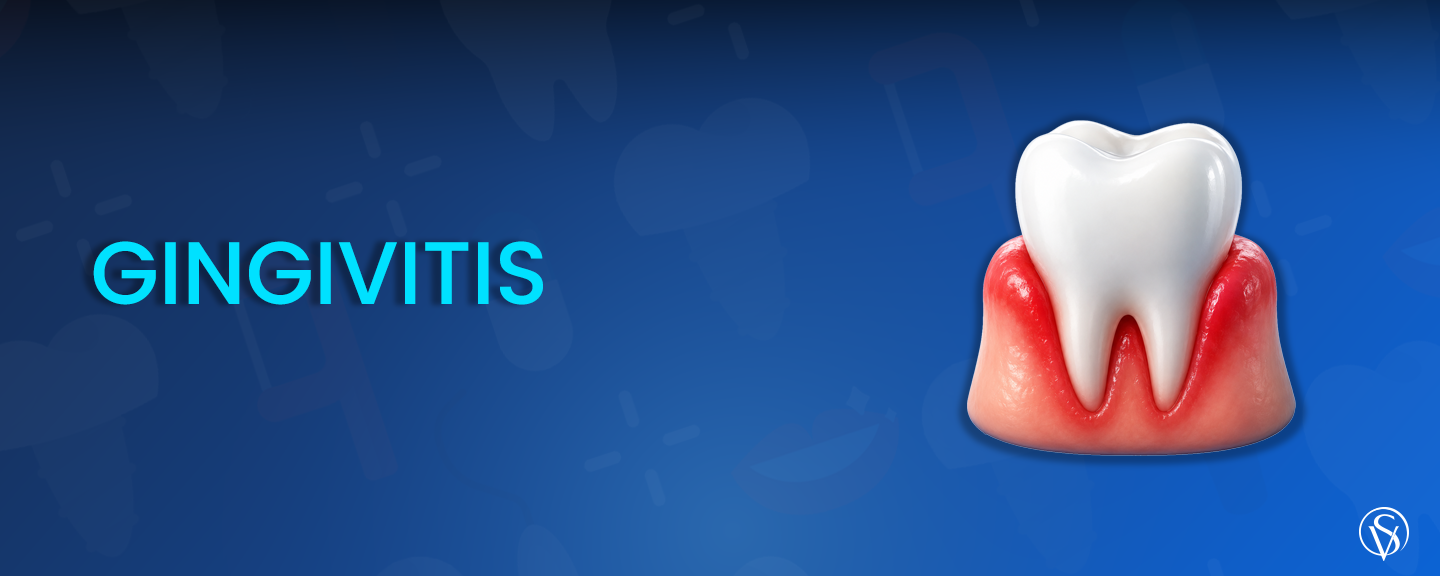 gingivitis