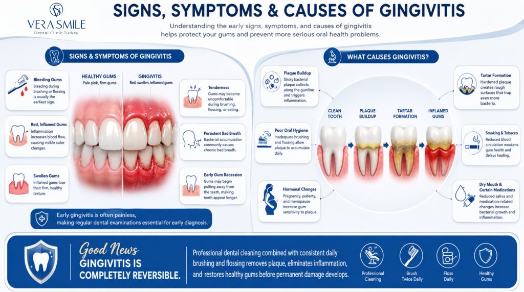 Infographic explaining the signs, symptoms, and causes of gingivitis, including early warning signs such as bleeding, redness, swelling, tenderness, bad breath, and gum recession, alongside the progression from plaque buildup to tartar and inflamed gums and the key factors that contribute to gum disease