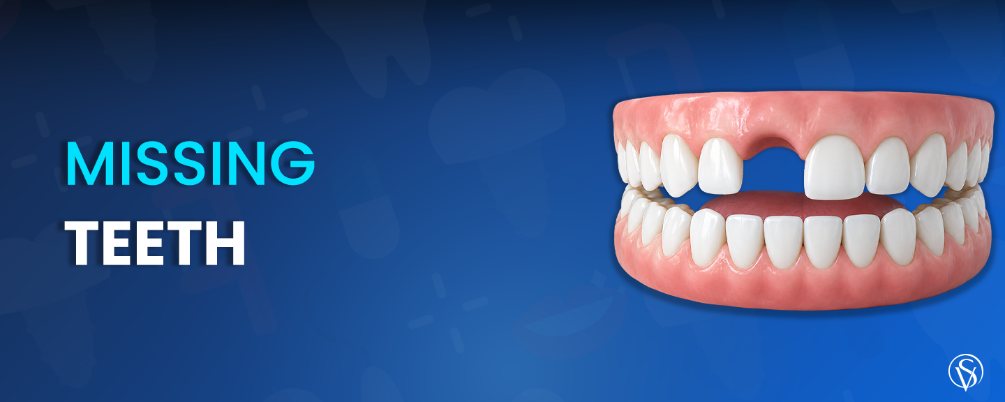 MISSING TEETH