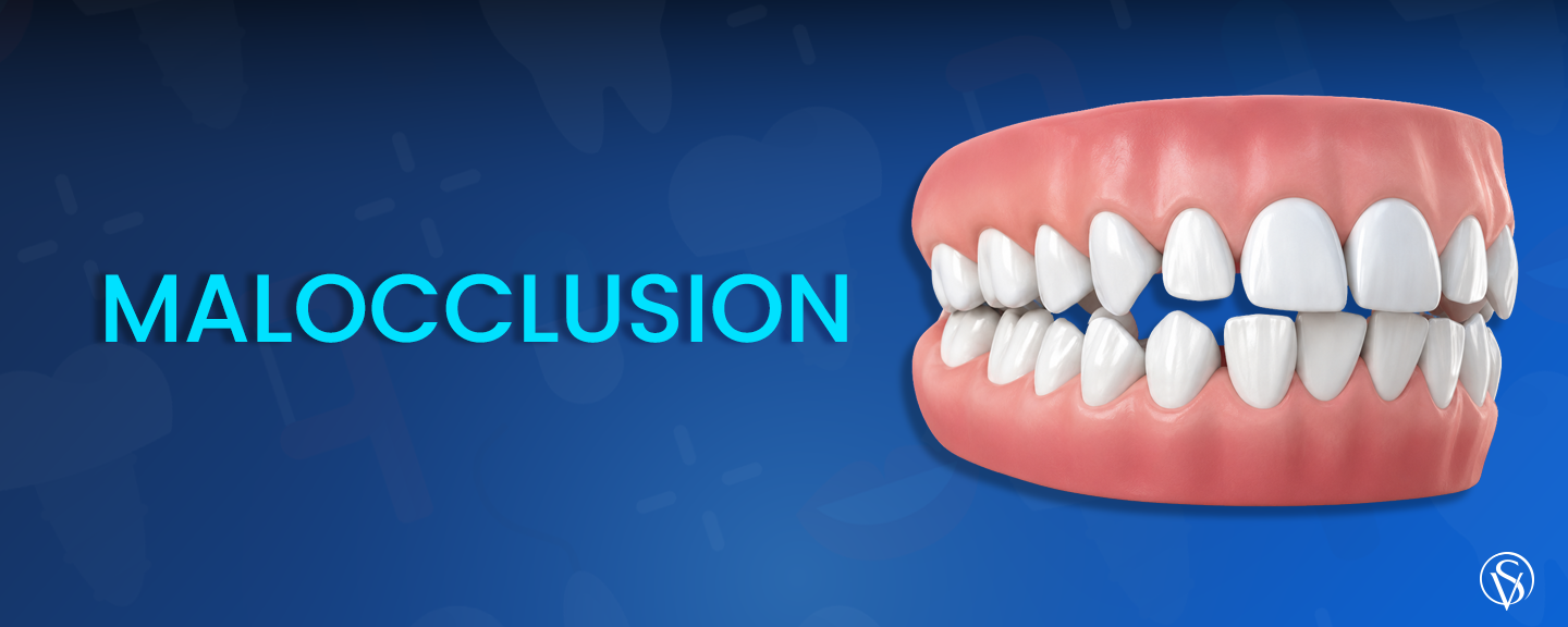 Malocclusion