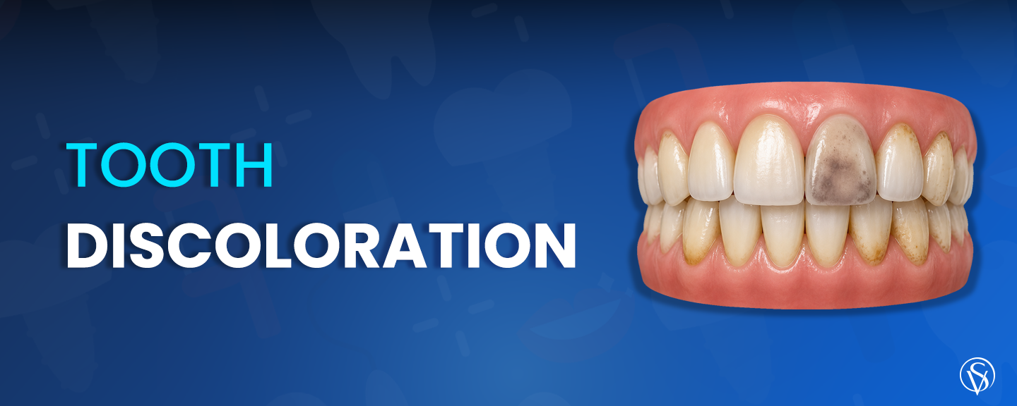 TOOTH DISCOLORATION