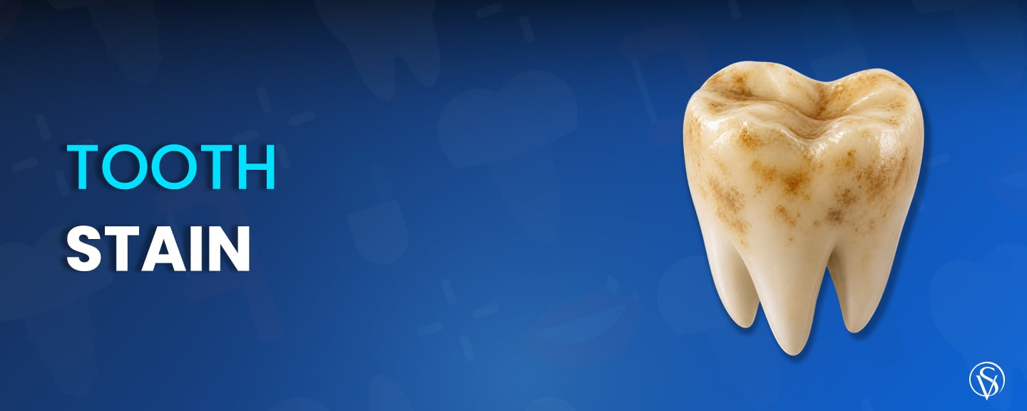 Tooth Stain