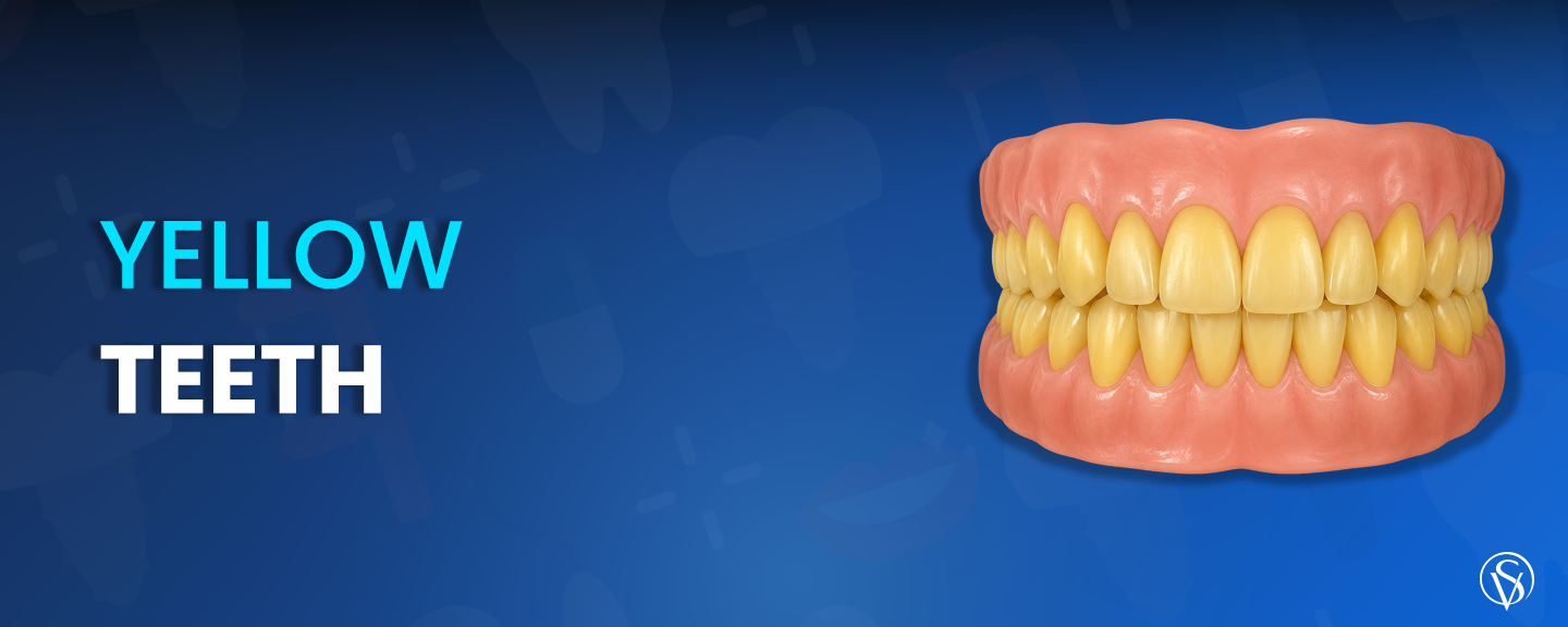 yellow teeth