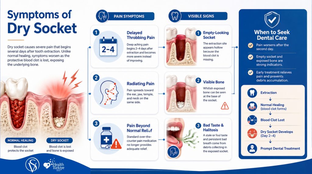Infographic showing the main symptoms of dry socket after tooth extraction, including worsening throbbing pain two to four days after extraction, pain radiating to the ear and jaw, an empty socket with exposed bone, bad taste, persistent bad breath, and pain that no longer responds to standard pain relief