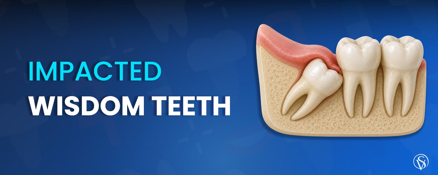 Impacted Wisdom Teeth