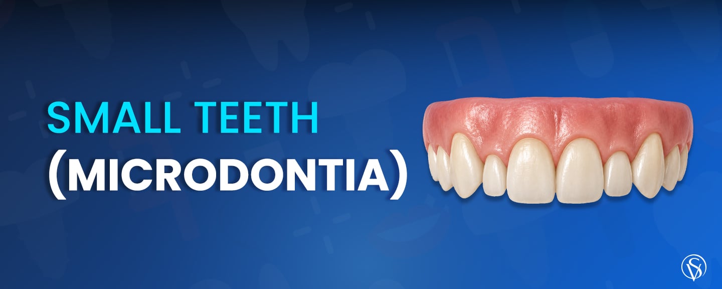 Small Teeth (Microdontia)