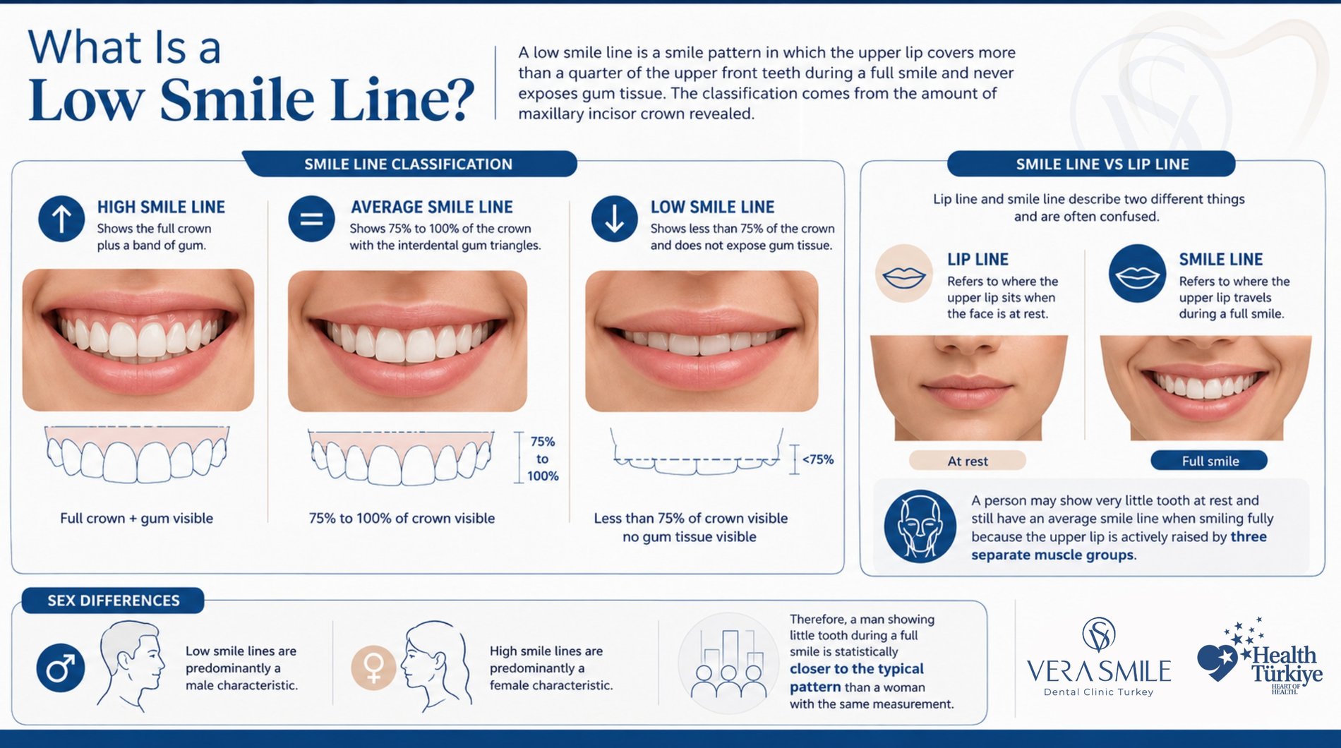 lsl low smile line classification, comparing high, average, and low smile lines by visible upper tooth crown and gum exposure, and distinguishing lip line at rest from smile line during a full smile